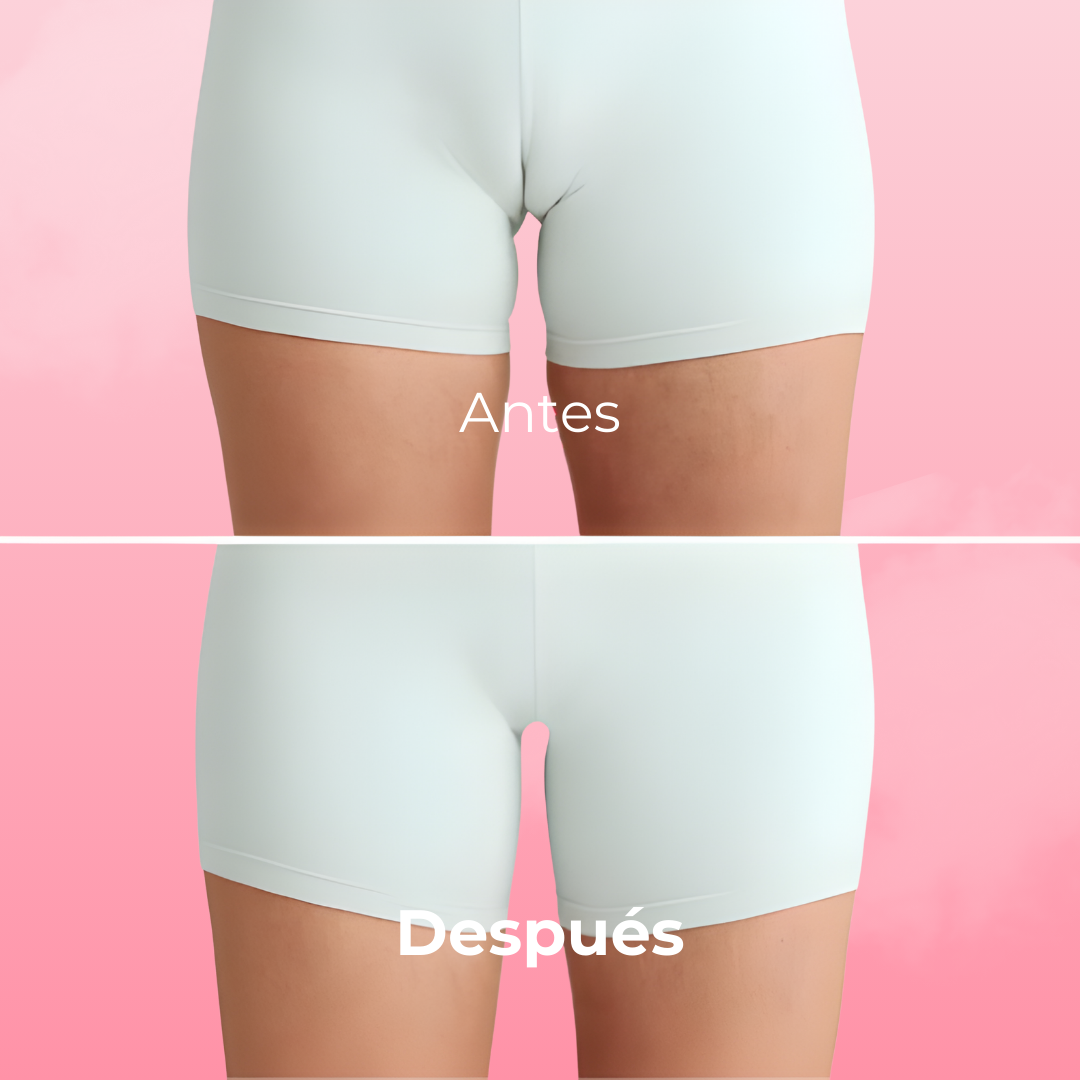 Tanga Anti-Camel Toe